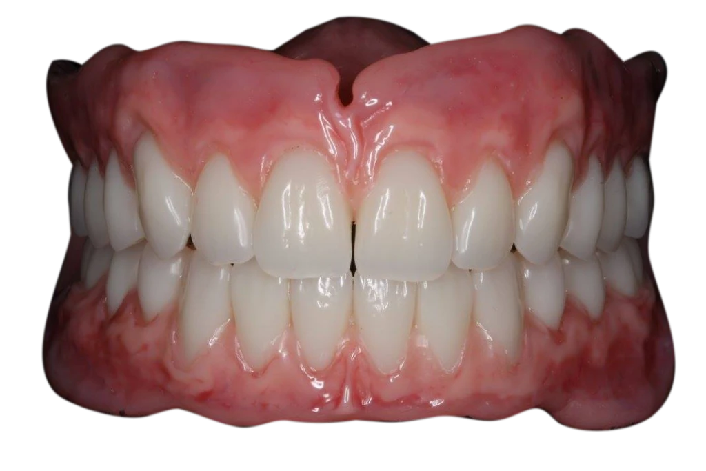 Image courtesy of Consett Denture Centre.
