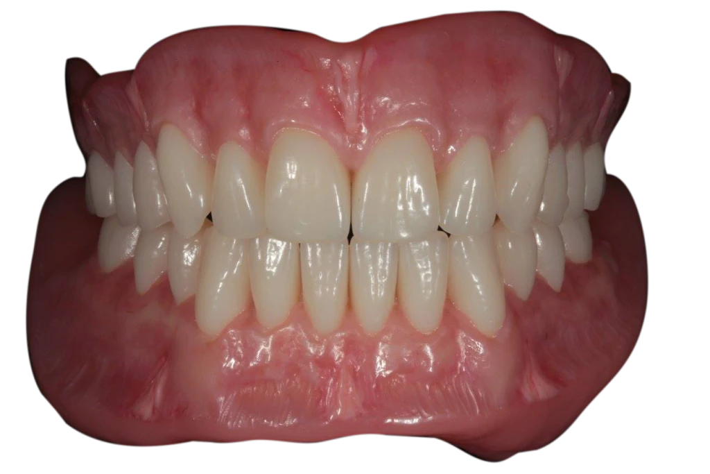 Image courtesy of Consett Denture Centre.